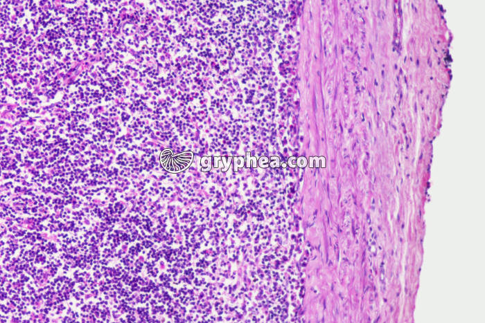 Ganglion lymphatique x50 - gryphea.org